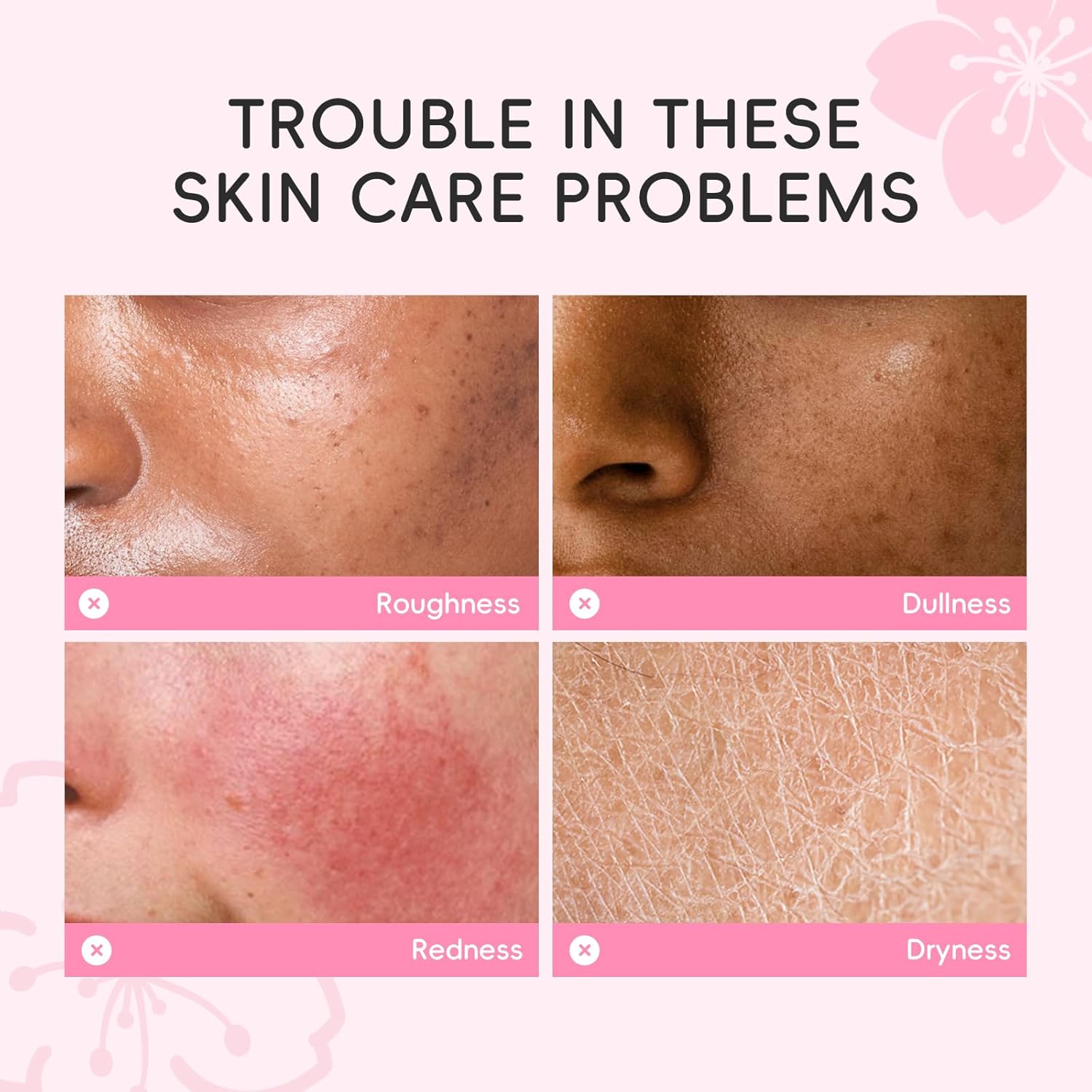 LAIKOU Sakura Gezichtsverzorgingsset, 11-delig, gezichtsverzorgingsset voor tieners, reishuidverzorgingsset met gezichtsreiniger, serum, vochtinbrengende crème, gezichtsmasker en moddermasker